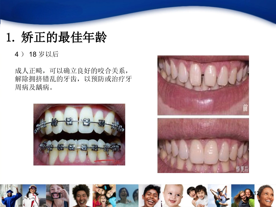儿童口腔知识宣教资料_第12页