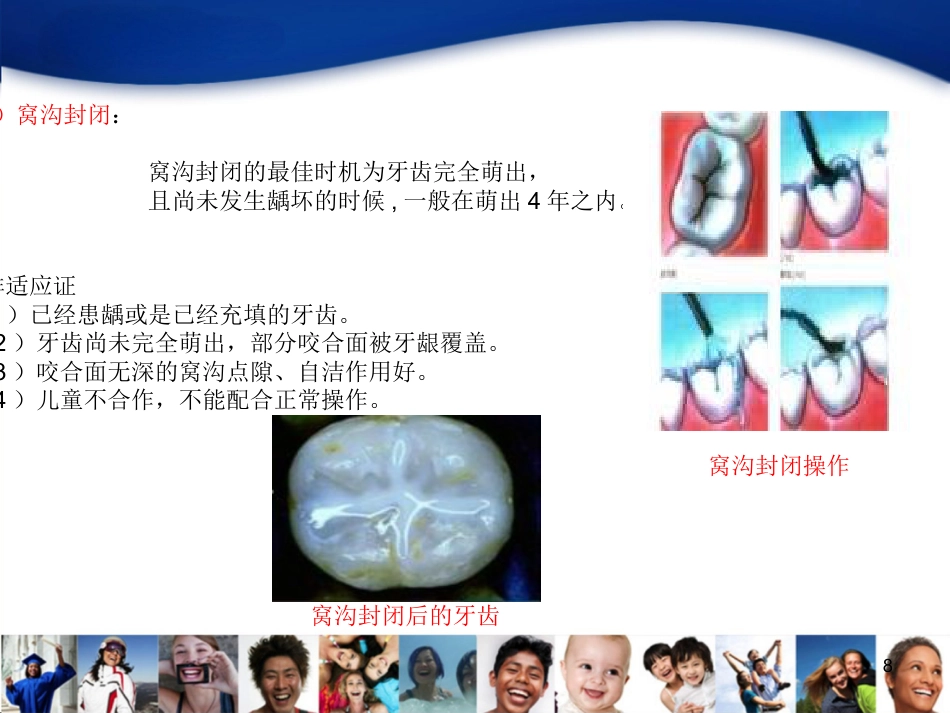 儿童口腔知识宣教资料_第8页
