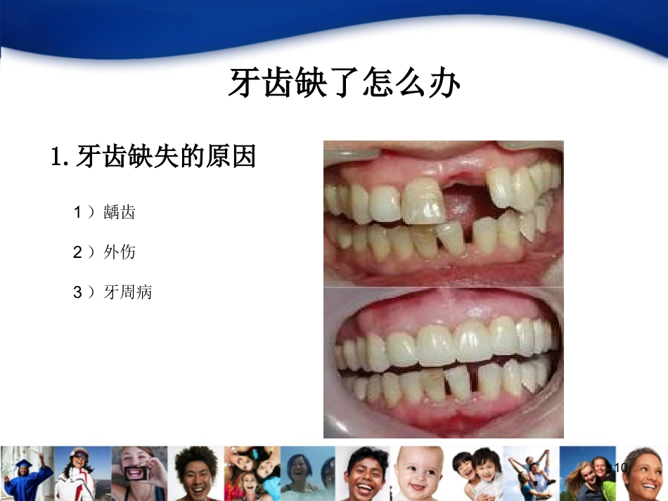 中青年口腔知识宣教资料_第10页