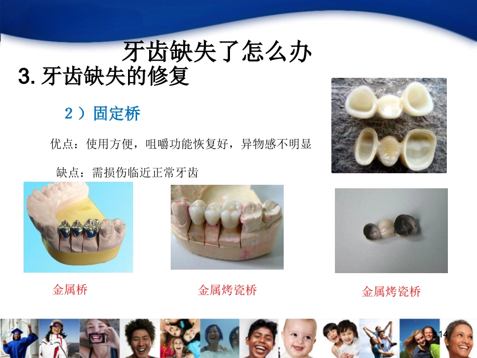 中青年口腔知识宣教资料_第14页