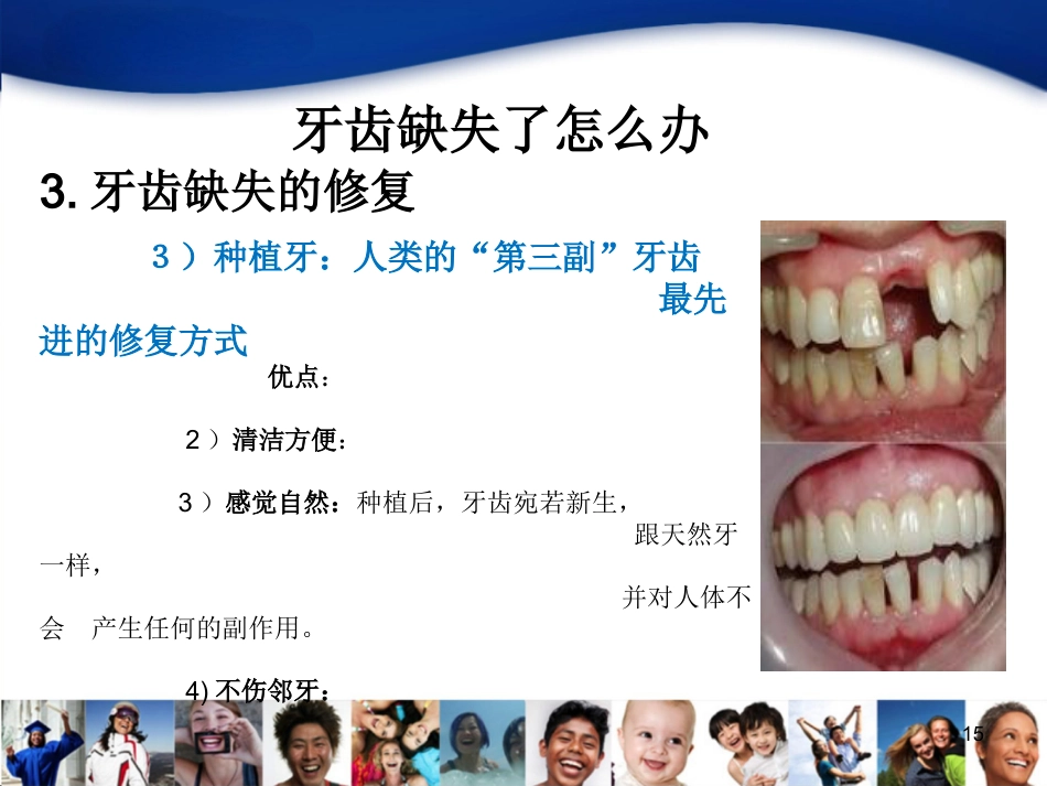 中青年口腔知识宣教资料_第15页