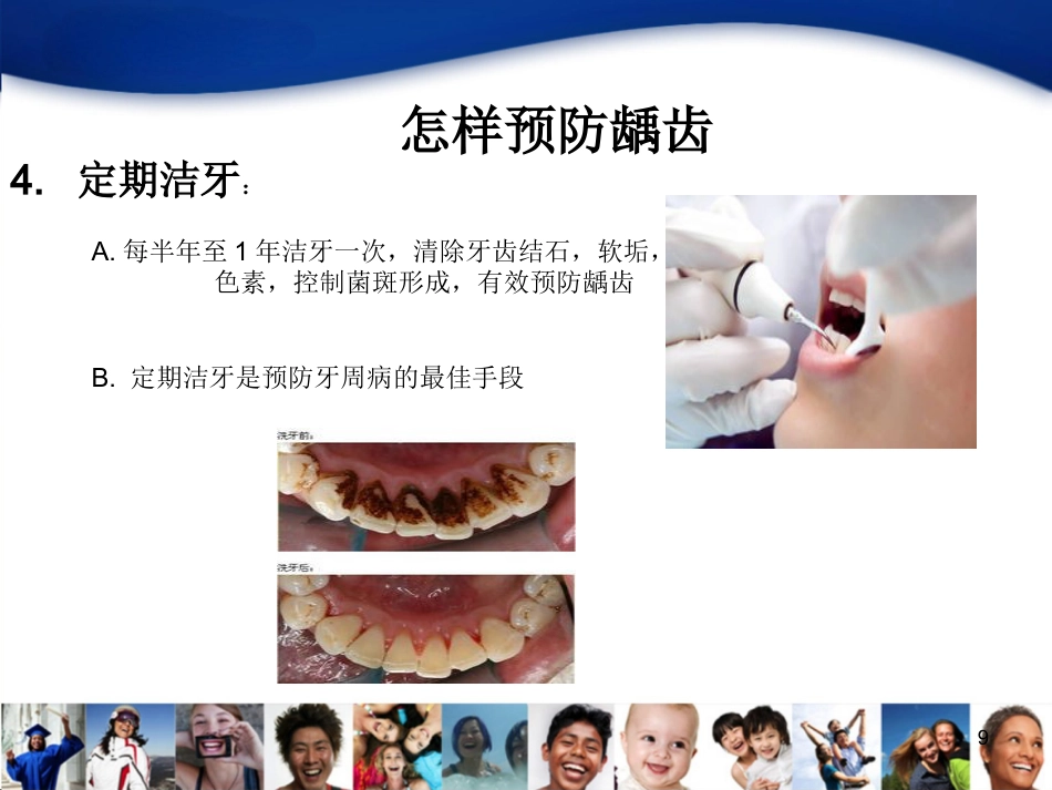 中青年口腔知识宣教资料_第9页