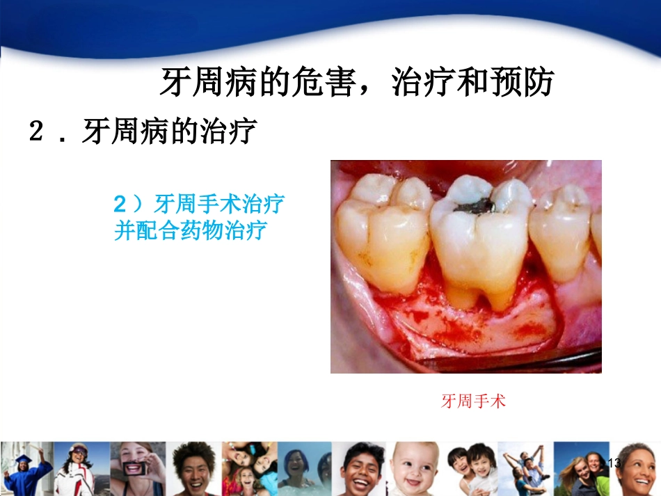 老年人口腔知识宣教资料_第13页