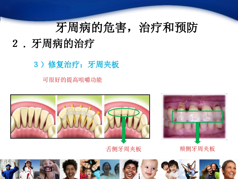 老年人口腔知识宣教资料_第14页