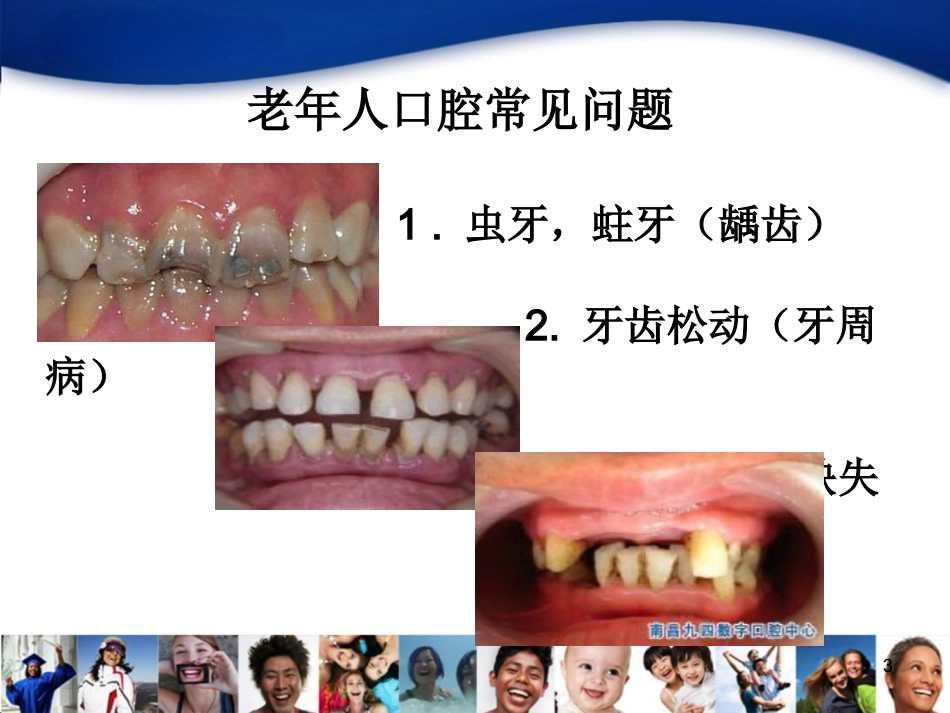 老年人口腔知识宣教资料_第3页