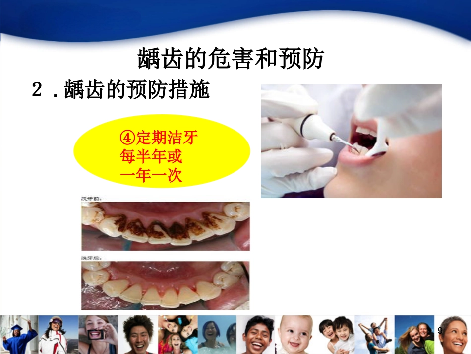 老年人口腔知识宣教资料_第9页