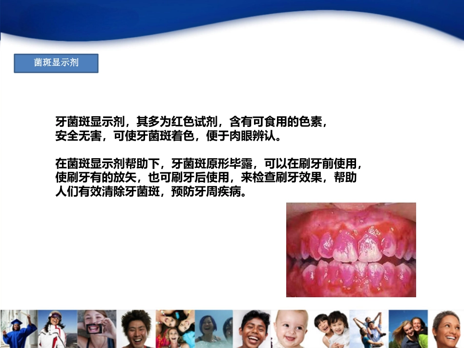 2-牙周病_第2页