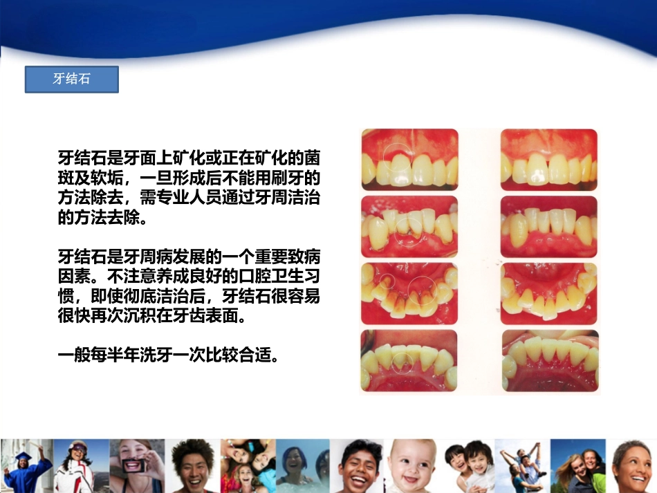 2-牙周病_第3页