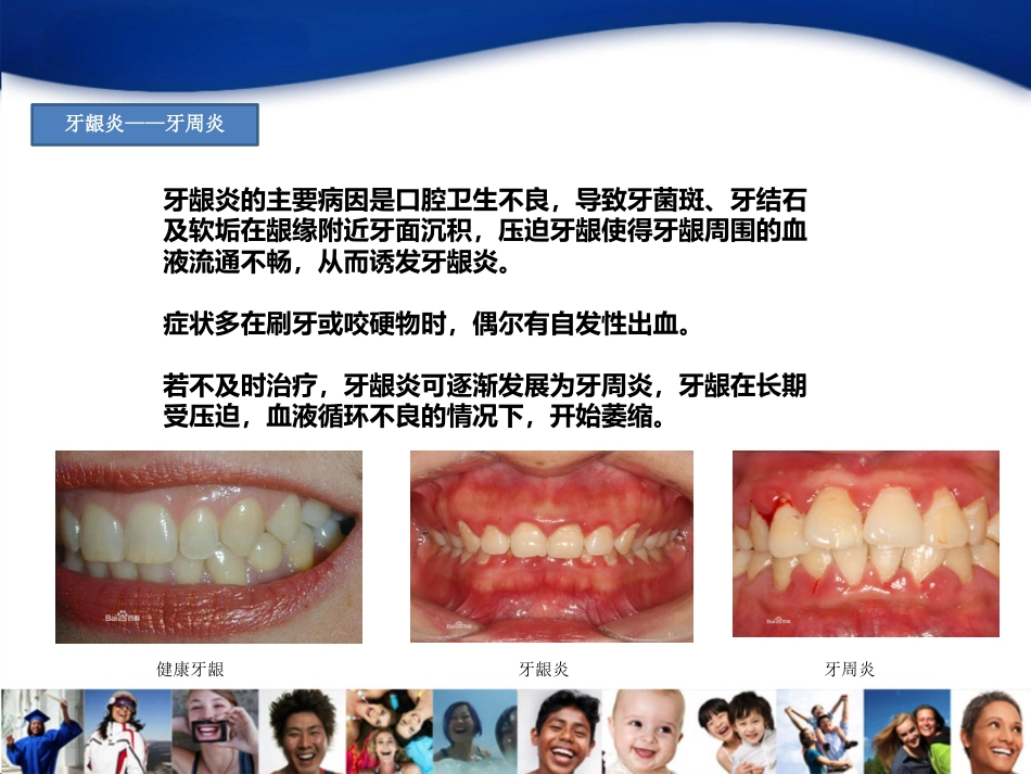 2-牙周病_第4页