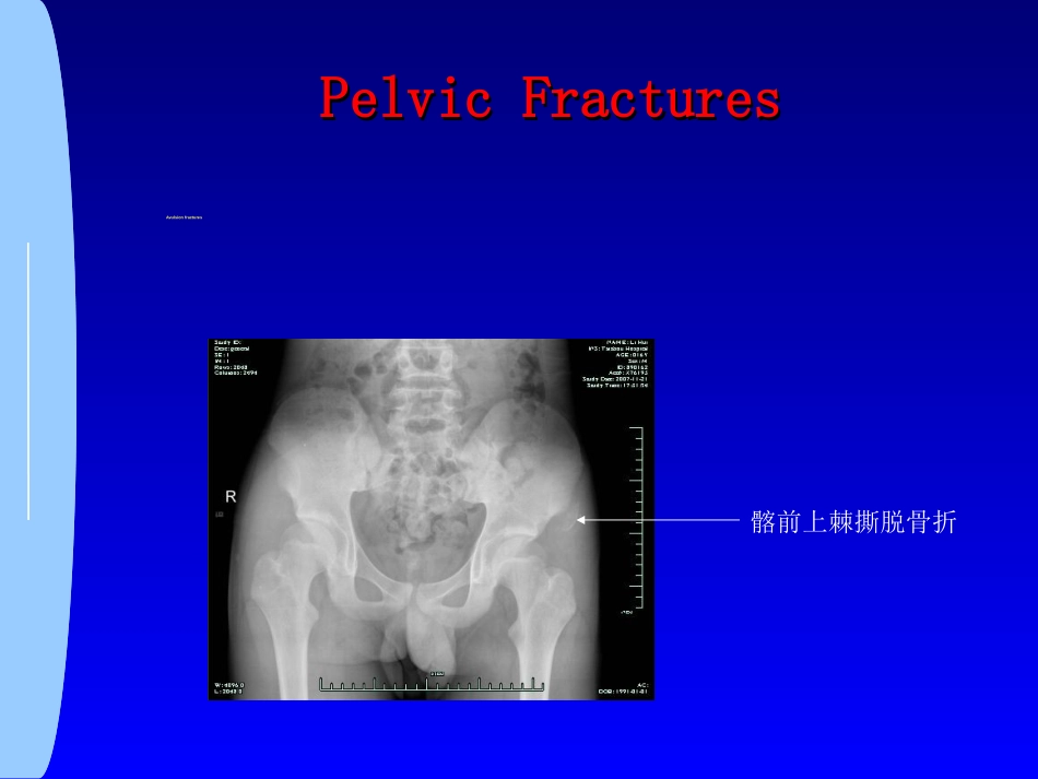骨科-骨盆骨折与下肢骨折_第7页