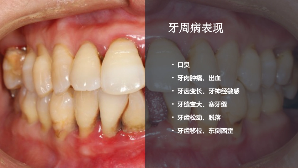 洁牙2_第5页