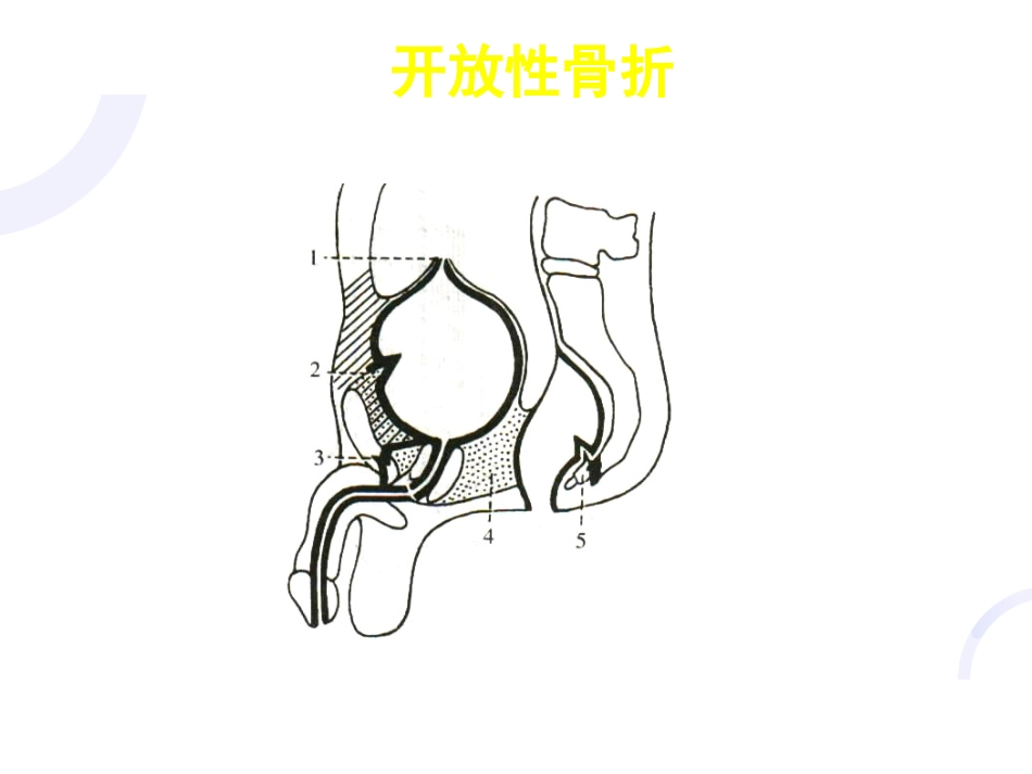 骨科-骨折概论（修改）_第15页