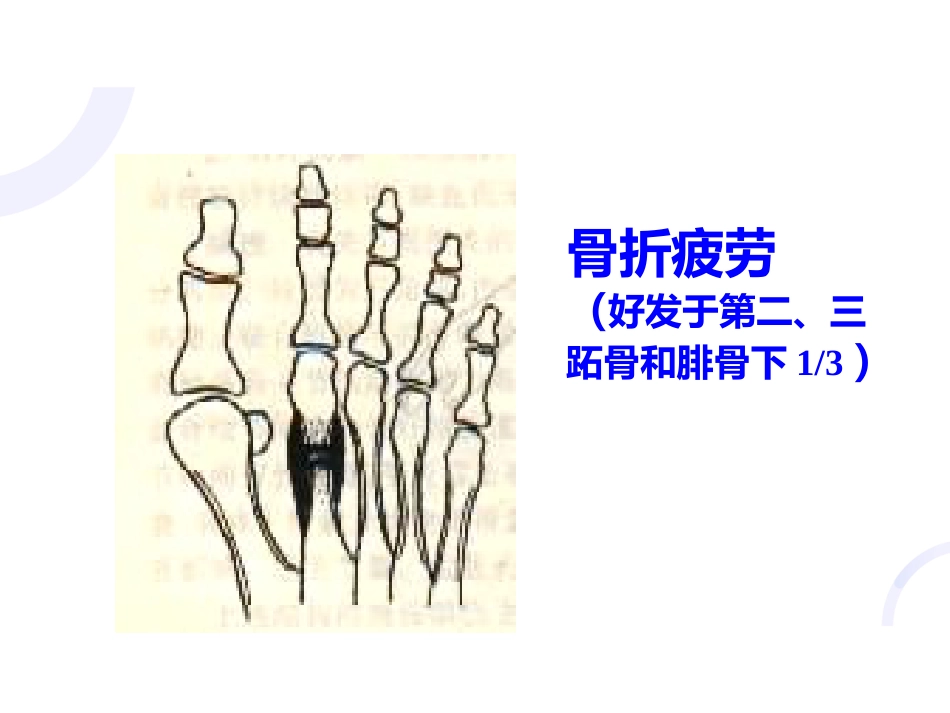 骨科-骨折概论（修改）_第8页