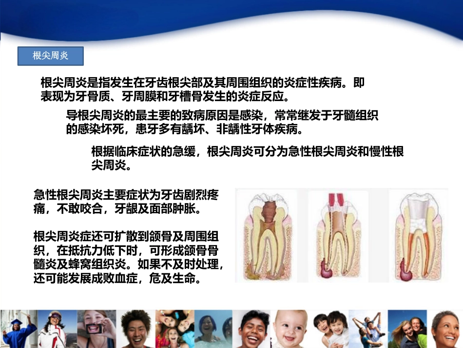 4-龋齿_第4页