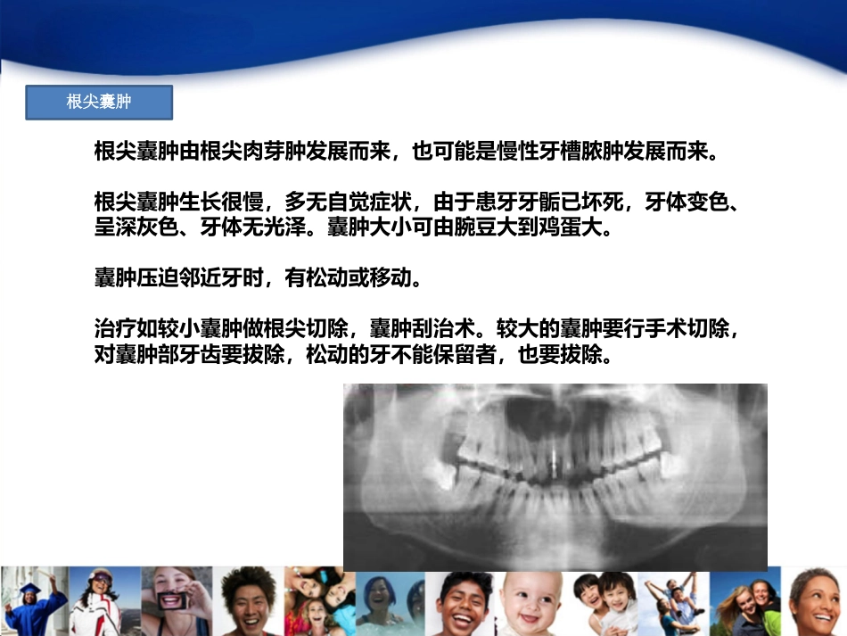 4-龋齿_第5页