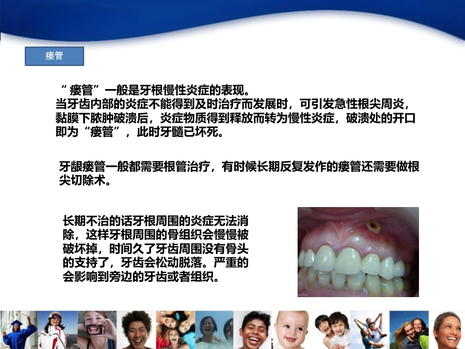 4-龋齿_第6页