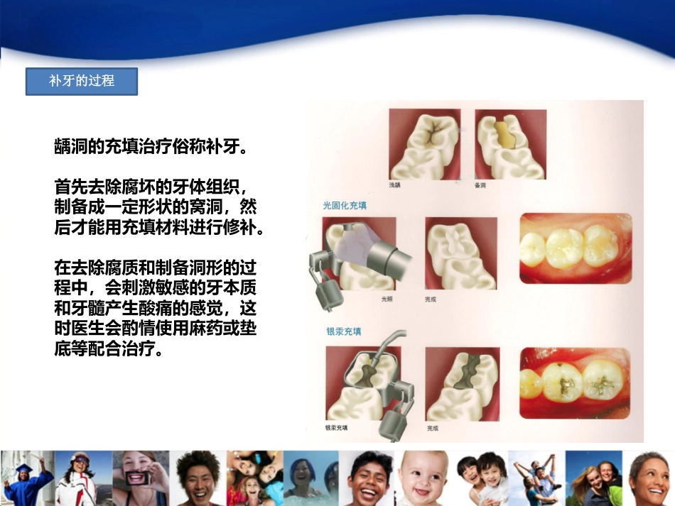 4-龋齿_第7页