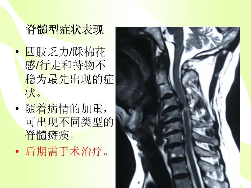 健康的颈椎源于生活习惯_第12页