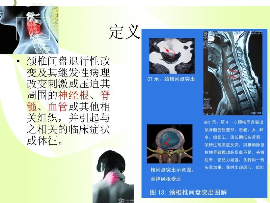 健康的颈椎源于生活习惯_第2页