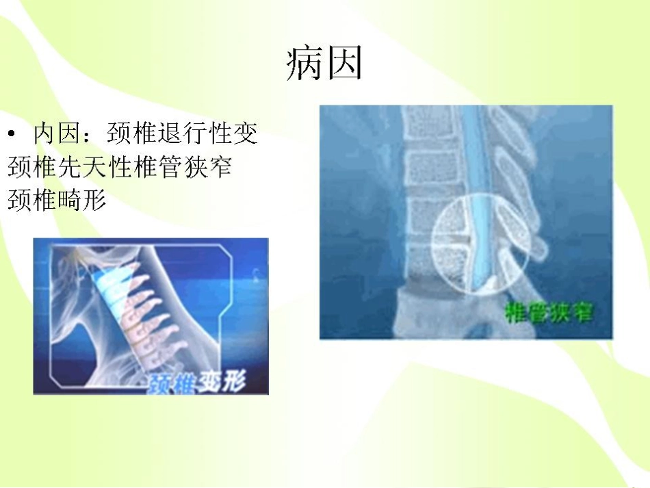 健康的颈椎源于生活习惯_第6页