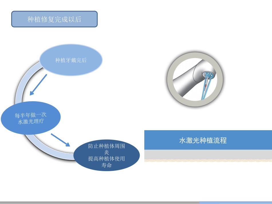 11.水激光种植_第7页
