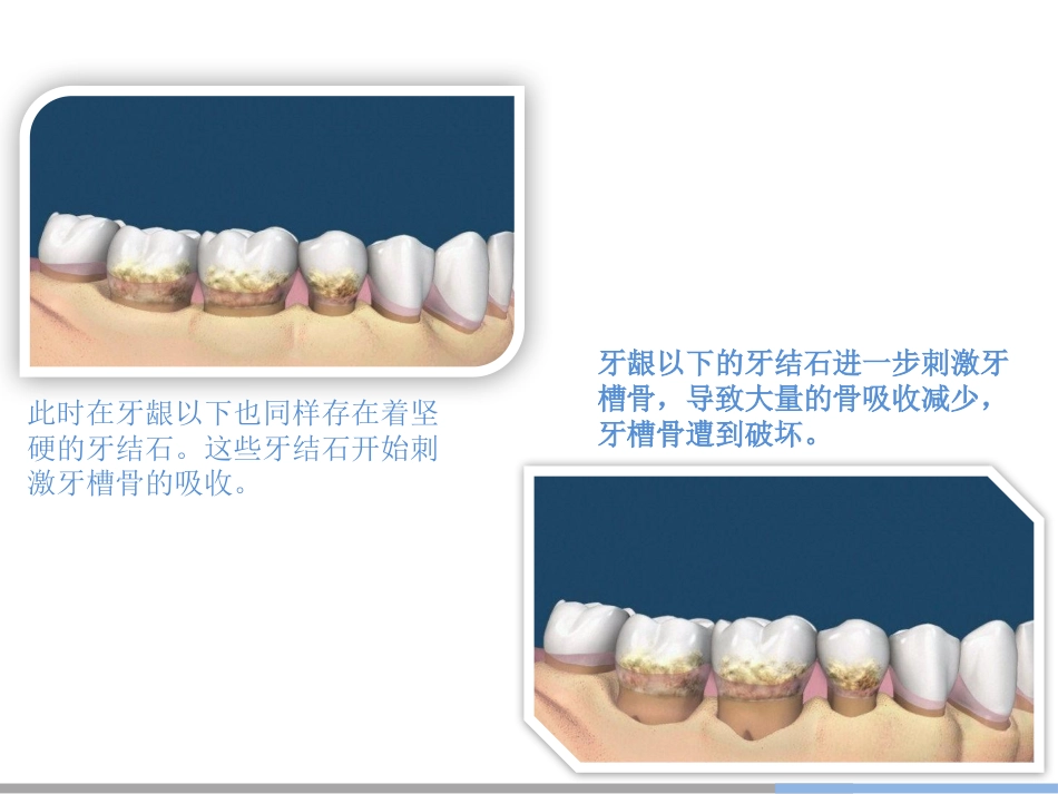 13.洗牙修改版_第8页