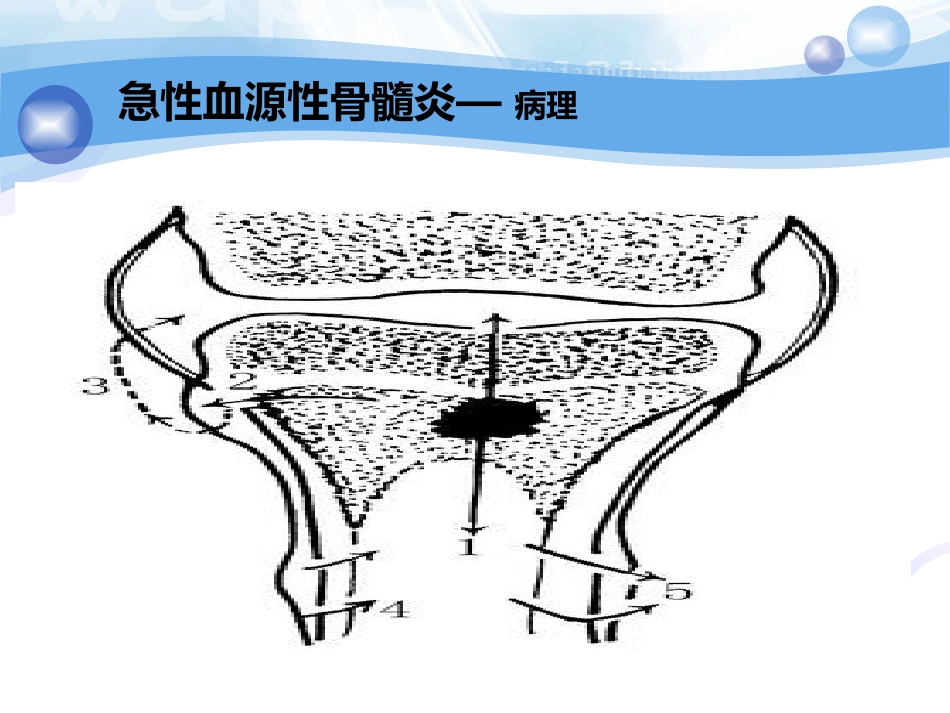骨科-骨与关节化脓性感染、结核_第9页
