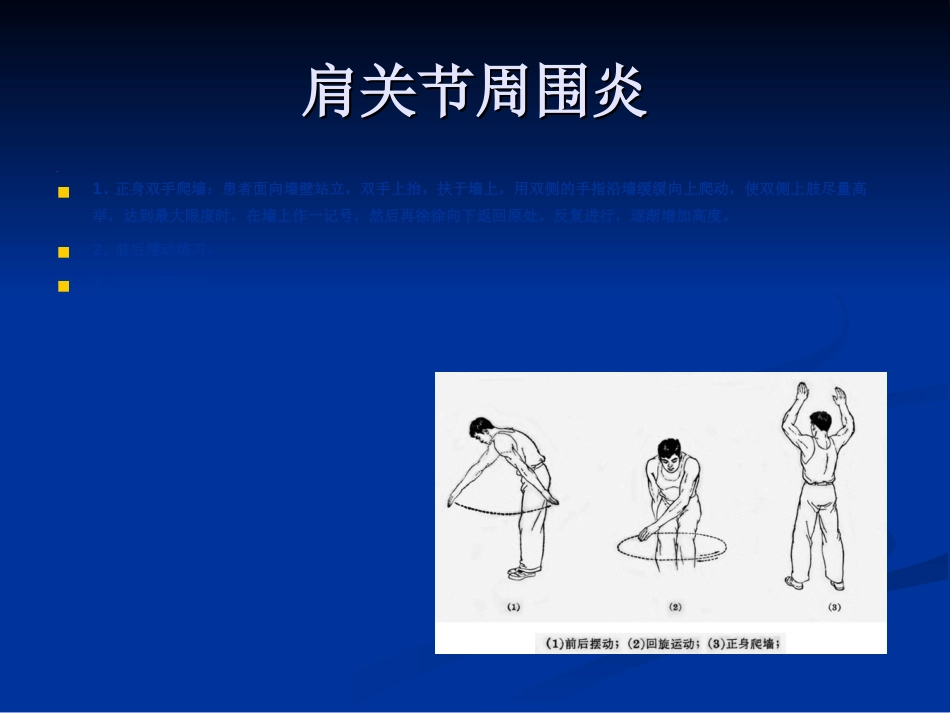 骨科-肩周炎的锻炼方法与治疗方法_第15页