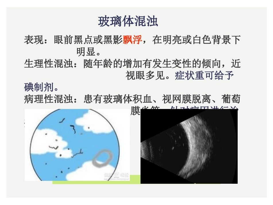 眼科小常识_第11页