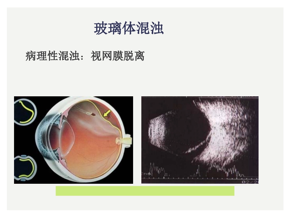 眼科小常识_第12页