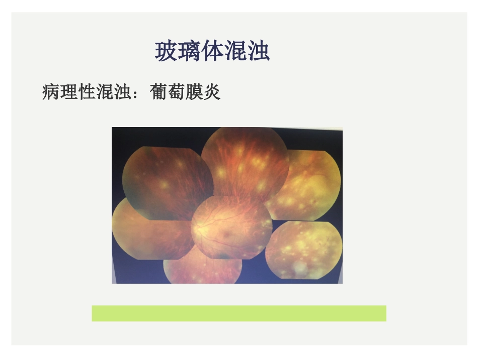 眼科小常识_第13页