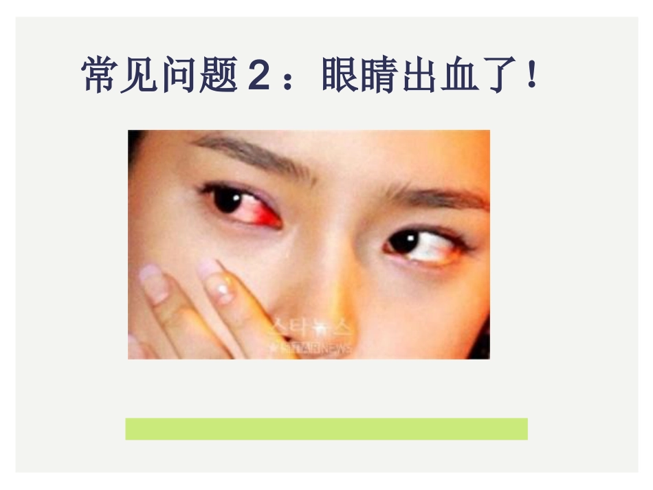 眼科小常识_第6页