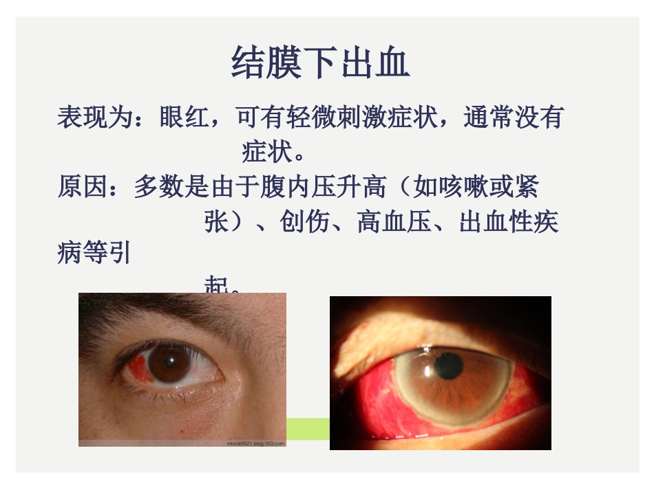 眼科小常识_第7页