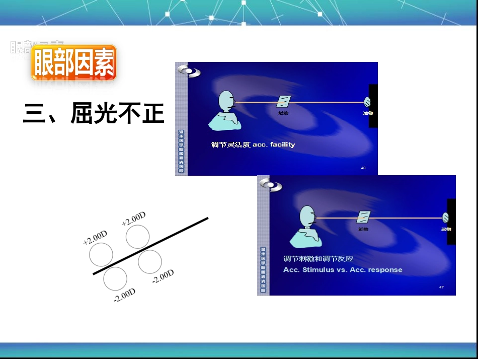 视疲劳_第10页