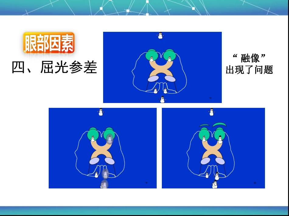 视疲劳_第11页