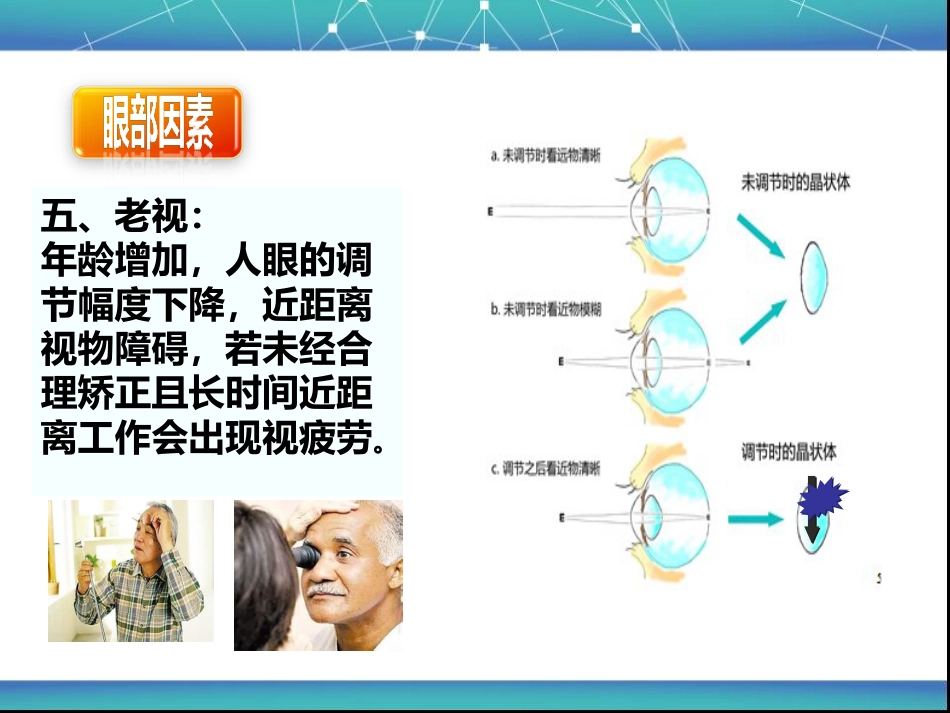 视疲劳_第12页