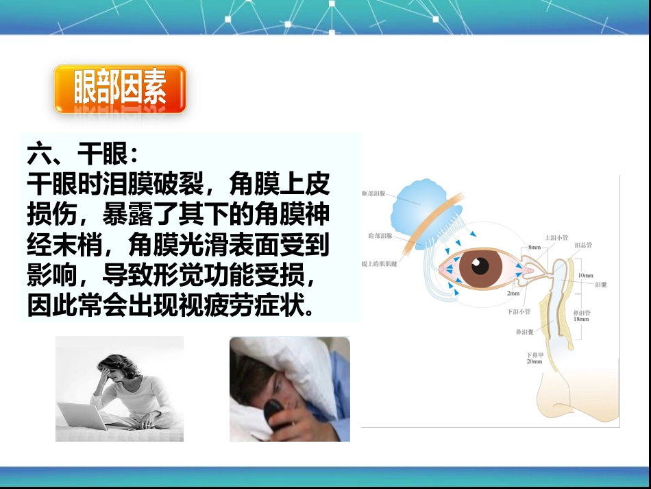 视疲劳_第13页