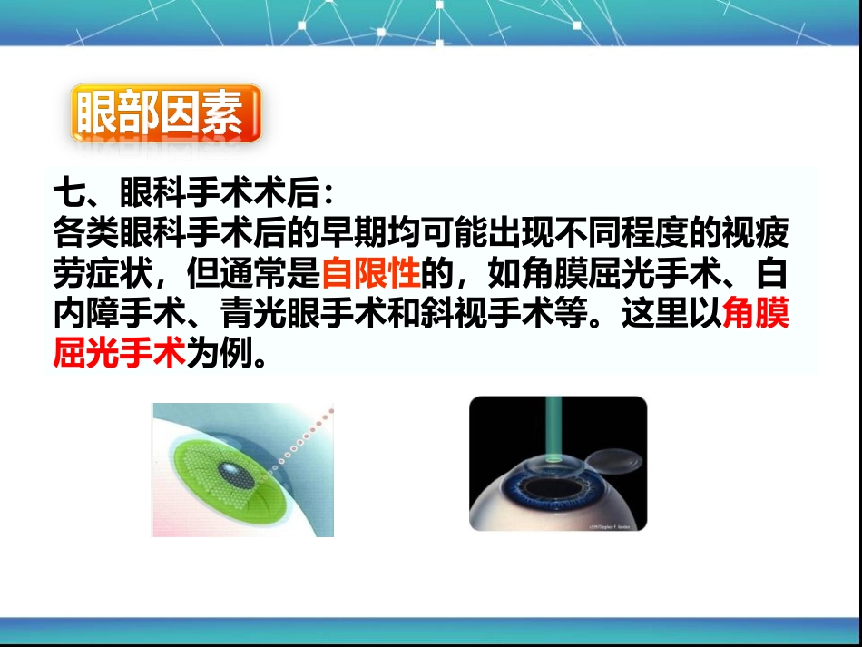 视疲劳_第14页
