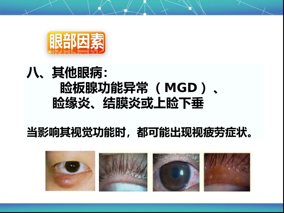 视疲劳_第15页