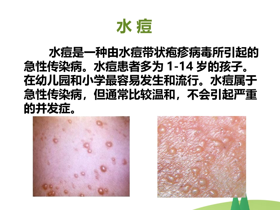 春季常见 传染病预防知识_第12页