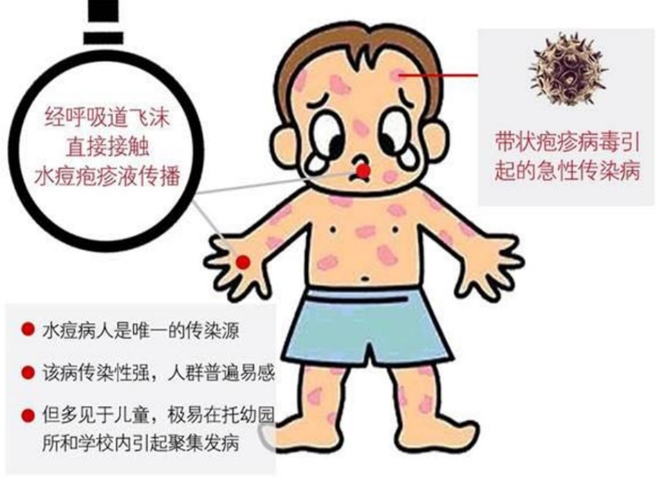 赶走磨人的水痘_第3页