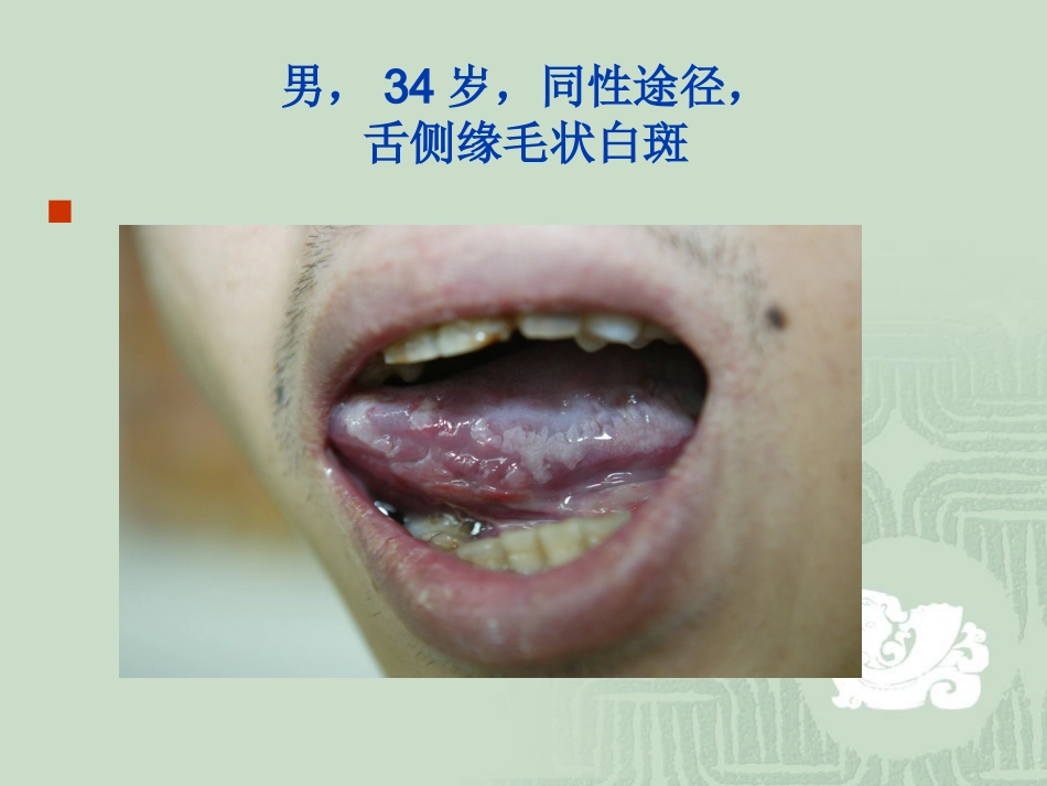 艾滋病_第11页