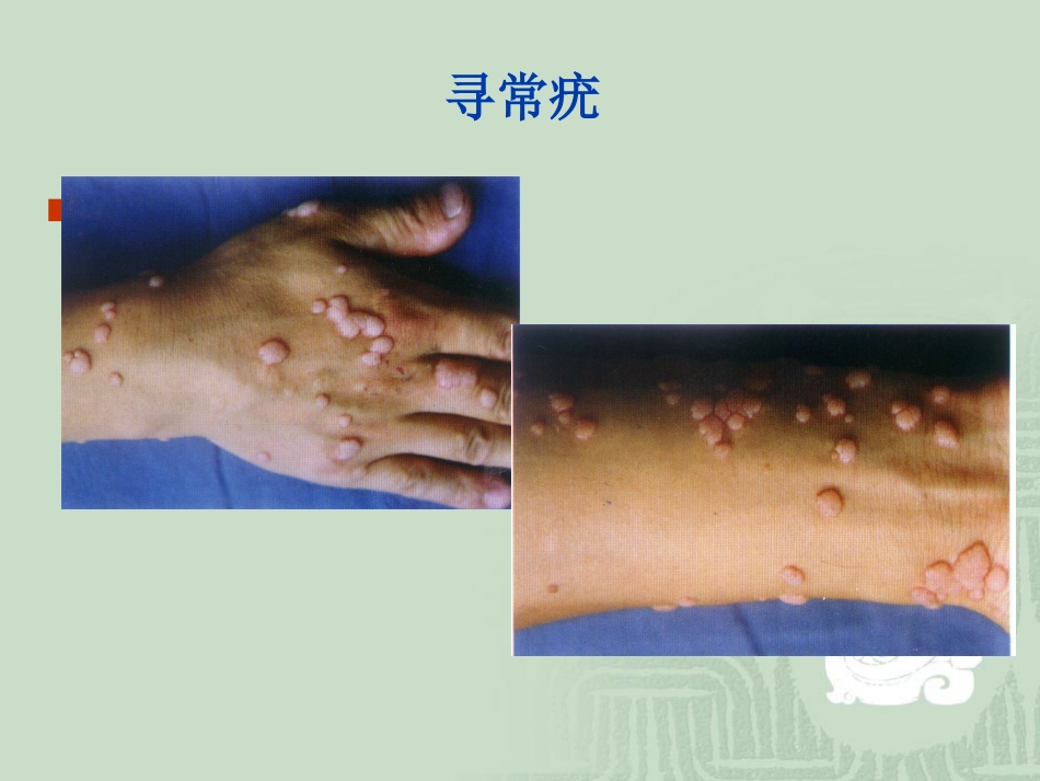 艾滋病_第9页