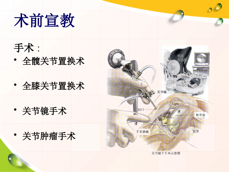 骨科病人健康宣教_第13页