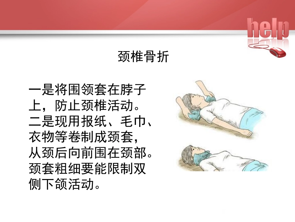 常见骨折的现场急救固定_第15页