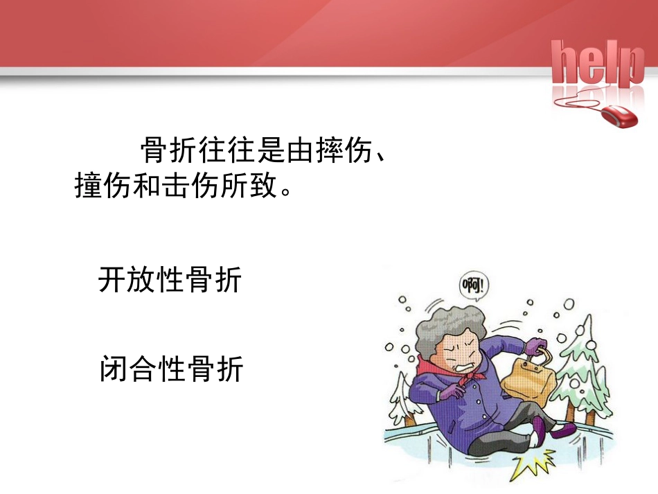 常见骨折的现场急救固定_第3页