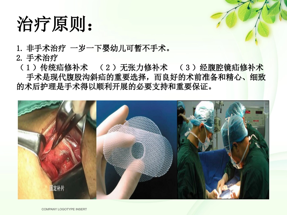 腹股沟斜疝健康宣教_第7页
