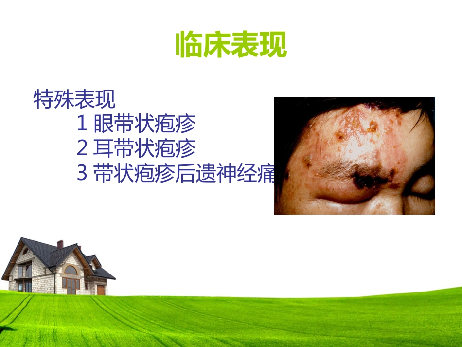 带状疱疹患者的护理及健康宣教_第7页