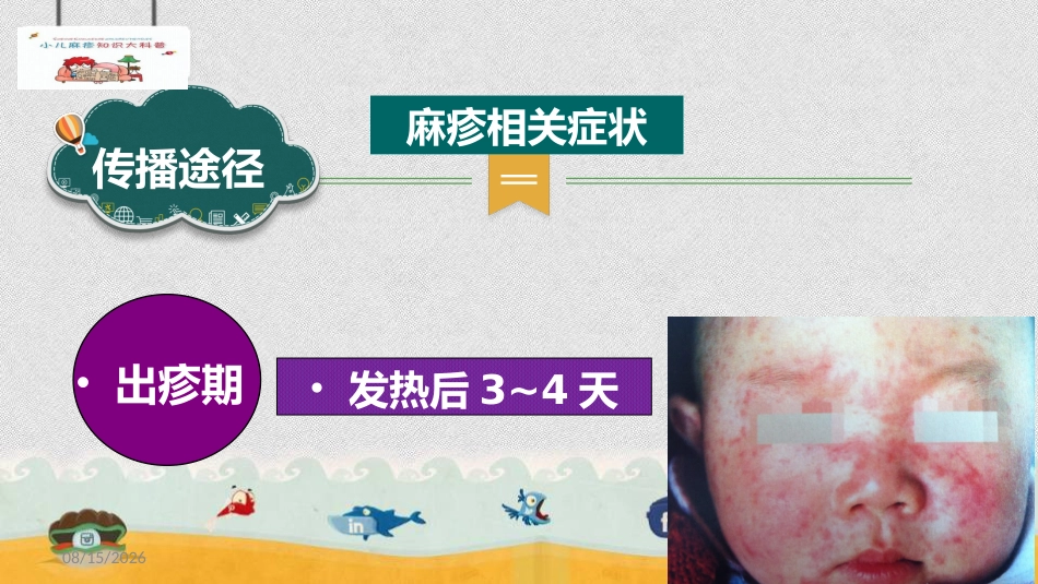 小儿麻疹科普_第10页