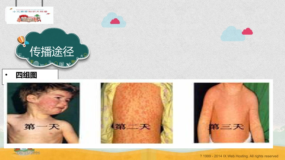 小儿麻疹科普_第12页